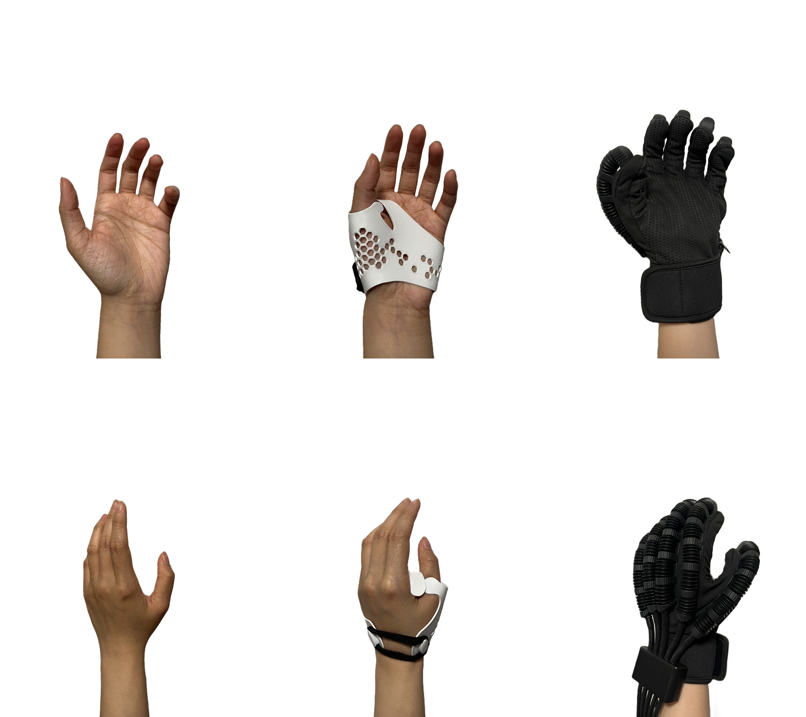 Variations of hardware braces for stroke rehab